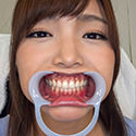 【歯フェチ】碧しのちゃんの歯を観察しました！