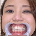 【歯フェチ】亜矢みつきちゃんの歯を観察しました！
