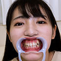 【歯フェチ】河奈亜依ちゃんの歯を観察しました！