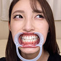 【歯フェチ】森沢かなちゃんの歯を観察しました！