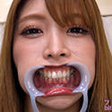 【歯フェチ】新村あかりちゃんの歯を観察しました！