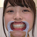 【歯フェチ】宮沢ちはるちゃんの歯を観察しました！
