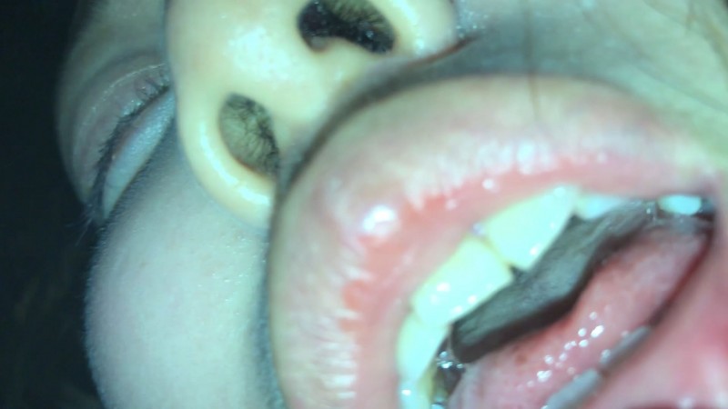 ねっちょねちょの口内にある治療痕のある歯と肉厚舌のコラボ アヤト② KITR00231