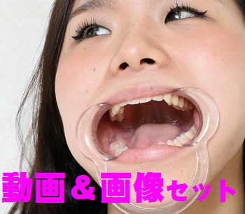 美沙ちゃんの歯は、32本揃ってます★★動画＆画像セット★★