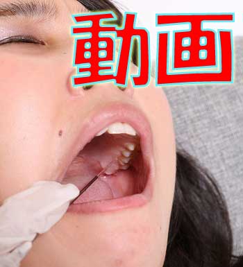 つかさちゃん、歯医者でのトラウマを語る　激痛　動画