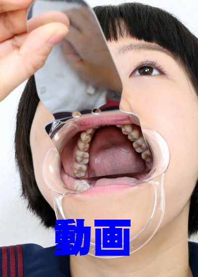 慶子ちゃんの歯　歯磨きがめんどくさーい　