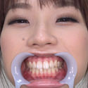 【歯フェチ】八乃つばさちゃんの歯を観察しました! 【歯フェチ】八乃つばさちゃんの歯を観察しました!