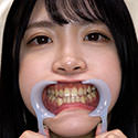 【歯フェチ】皆瀬あかりちゃんの歯を観察しました！