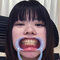 【歯フェチ】成田まつり女王様の歯を観察させていただきました! 【歯フェチ】成田まつり女王様の歯を観察させていただきました!