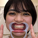 【歯フェチ】天晴乃愛ちゃんの歯を観察しました！