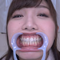 【歯フェチ】美泉咲ちゃんの歯を観察しました!【特典動画付】 【歯フェチ】美泉咲ちゃんの歯を観察しました!【特典動画付】
