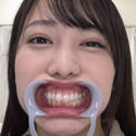 【歯フェチ】弥生みづきちゃんの歯を観察しました! 【歯フェチ】弥生みづきちゃんの歯を観察しました!