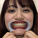 【歯フェチ】永澤ゆきのちゃんの歯を観察しました！