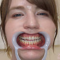 【歯フェチ】ジューン・ラブジョイちゃんの歯を観察しました！