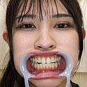 【歯フェチ】盛岡みゆちゃんの歯を観察しました！
