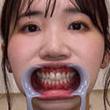 【歯フェチ】弘前綾香ちゃんの歯を観察しました！