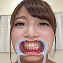 【歯フェチ】高美はるかちゃんの歯を観察しました！