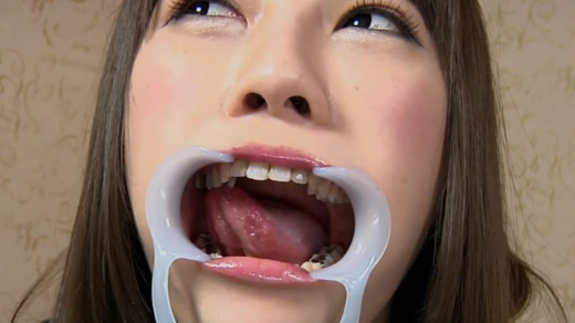 銀歯フェチ! 歯観察 ユリちゃん 銀歯フェチ! 歯観察 ユリちゃん