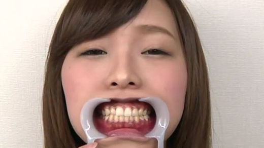 歯フェチ 痛い！小田エリナちゃんの虫歯観察