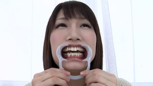歯観察 みくにちゃん 歯観察 みくにちゃん